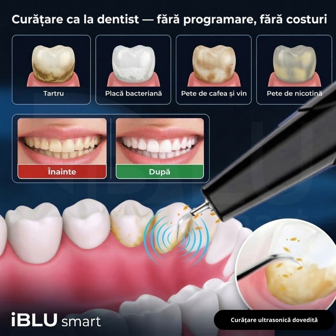 Rezultate aparat detartraj iBLU smart — eliminare tartru, pete cafea, nicotină și placă bacteriană acasăd