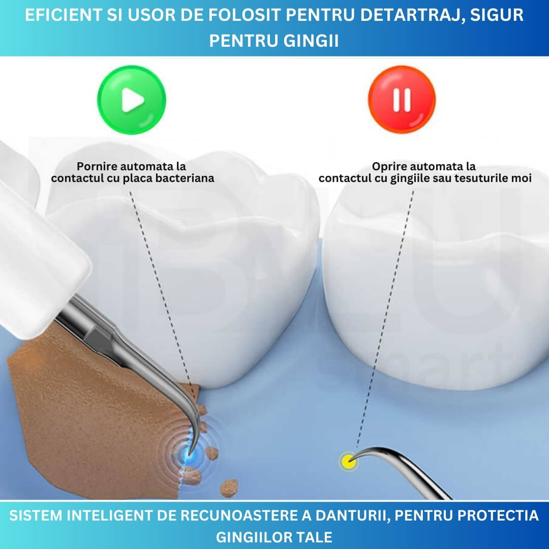Aparat pentru Eliminare Tartru iBLU smart, Detartraj Ultrasonic, Eliminare Placa Bacteriana, 5 Moduri pentru Curatarea Dintilor, 3 Capete Curatare si Oglinda Dentara Incluse, Lumina LED Puternica, Portabil si Reincarcabil, Rezistent la Apa, Alb