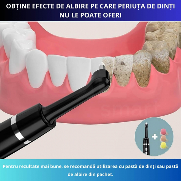 Aparat pentru Curățarea, Albirea și Lustruirea Dintilor, 5 Capete și Pastă pentru Albire, Negru [4]