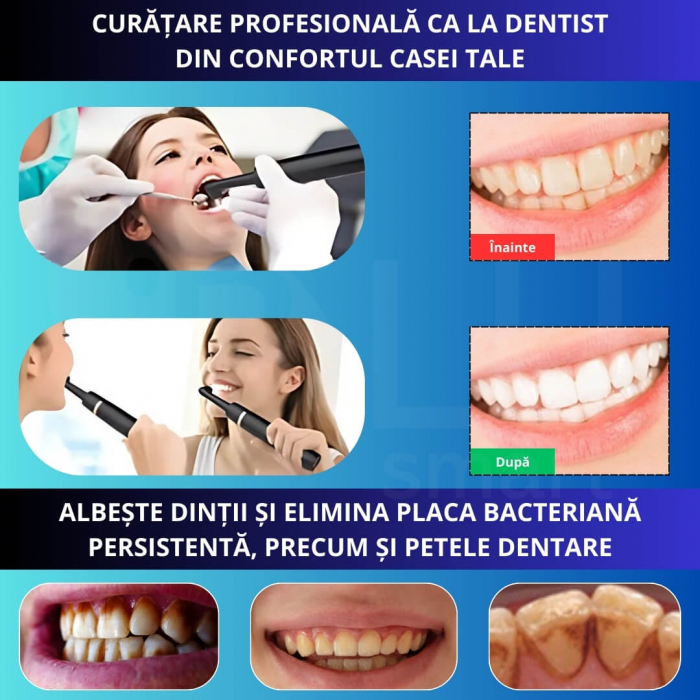 Aparat pentru Curățarea, Albirea și Lustruirea Dintilor, 5 Capete și Pastă pentru Albire, Negru [2]