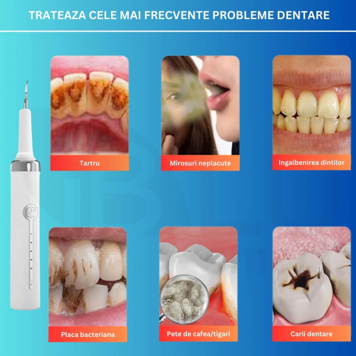 Aparat pentru Eliminare Tartru iBLU smart, Detartraj Ultrasonic [3]