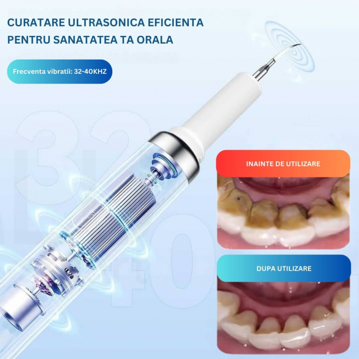 Aparat pentru Eliminare Tartru iBLU smart, Detartraj Ultrasonic [4]