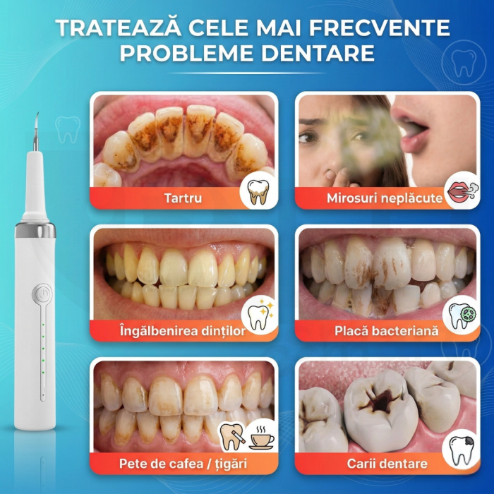 Aparat pentru Eliminare Tartru iBLU smart, Detartraj Ultrasonic, Eliminare Placa Bacteriana, 5 Moduri pentru Curatarea Dintilor, 3 Capete Curatare si Oglinda Dentara Incluse, Lumina LED Puternica, Portabil si Reincarcabil, Rezistent la Apa, Alb [3]
