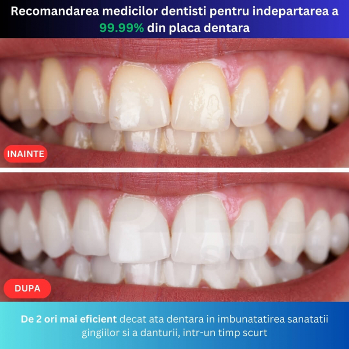 Irigator Oral Profesional cu Sterilizare UV pentru Duș bucal [2]