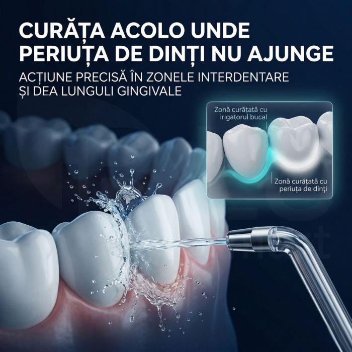 Irigator Oral Profesional cu Sterilizare UV pentru Duș bucal [7]