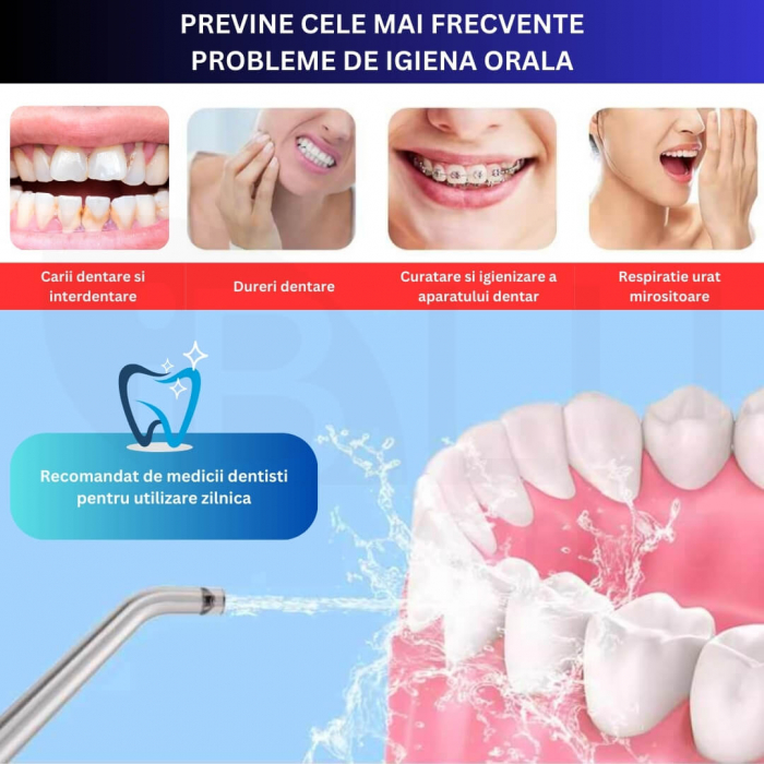 Irigator Oral Profesional cu Sterilizare UV pentru Duș bucal [4]
