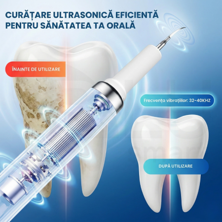 Aparat pentru Eliminare Tartru iBLU smart, Detartraj Ultrasonic, Eliminare Placa Bacteriana, 5 Moduri pentru Curatarea Dintilor, 3 Capete Curatare si Oglinda Dentara Incluse, Lumina LED Puternica, Portabil si Reincarcabil, Rezistent la Apa, Alb [3]