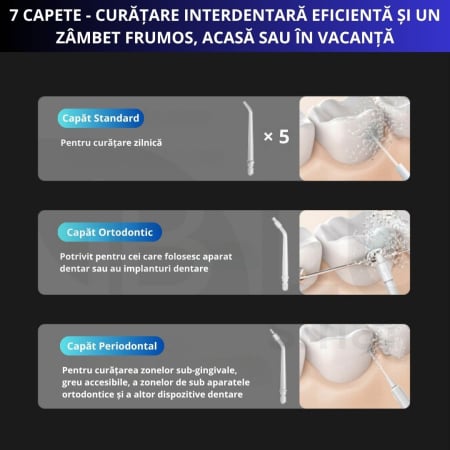 Irigator Oral Profesional Slim pentru Duș Bucal cu Rezervor Retractabil si Gravity Ball, 4 Capete, Negru [3]