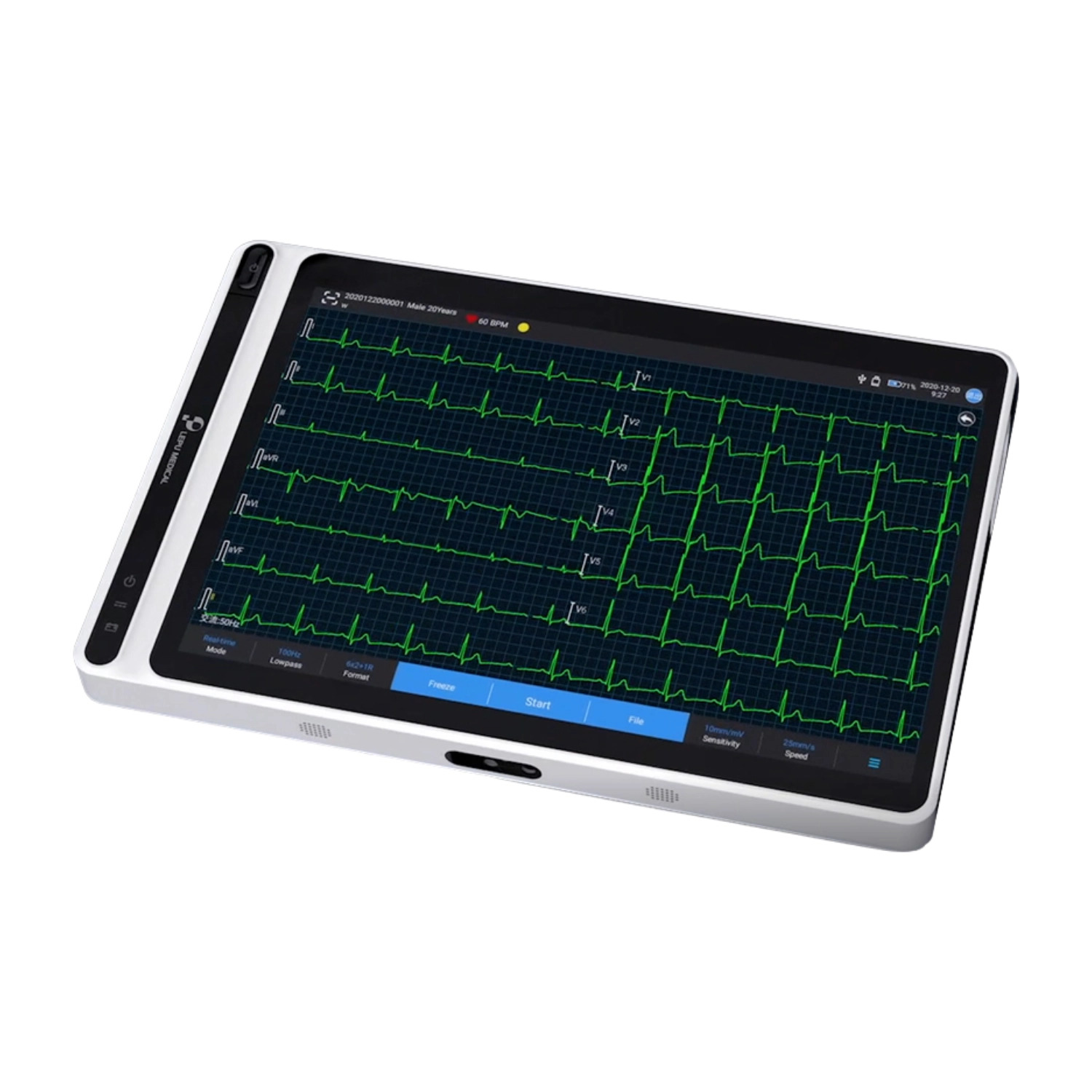 Medicina muncii - Electrocardiograf cu 12 canale tip tabletă cu imprimantă detașabilă