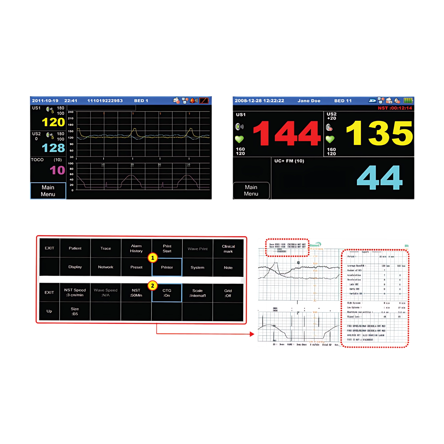 Monitor fetal FC1400 [2]
