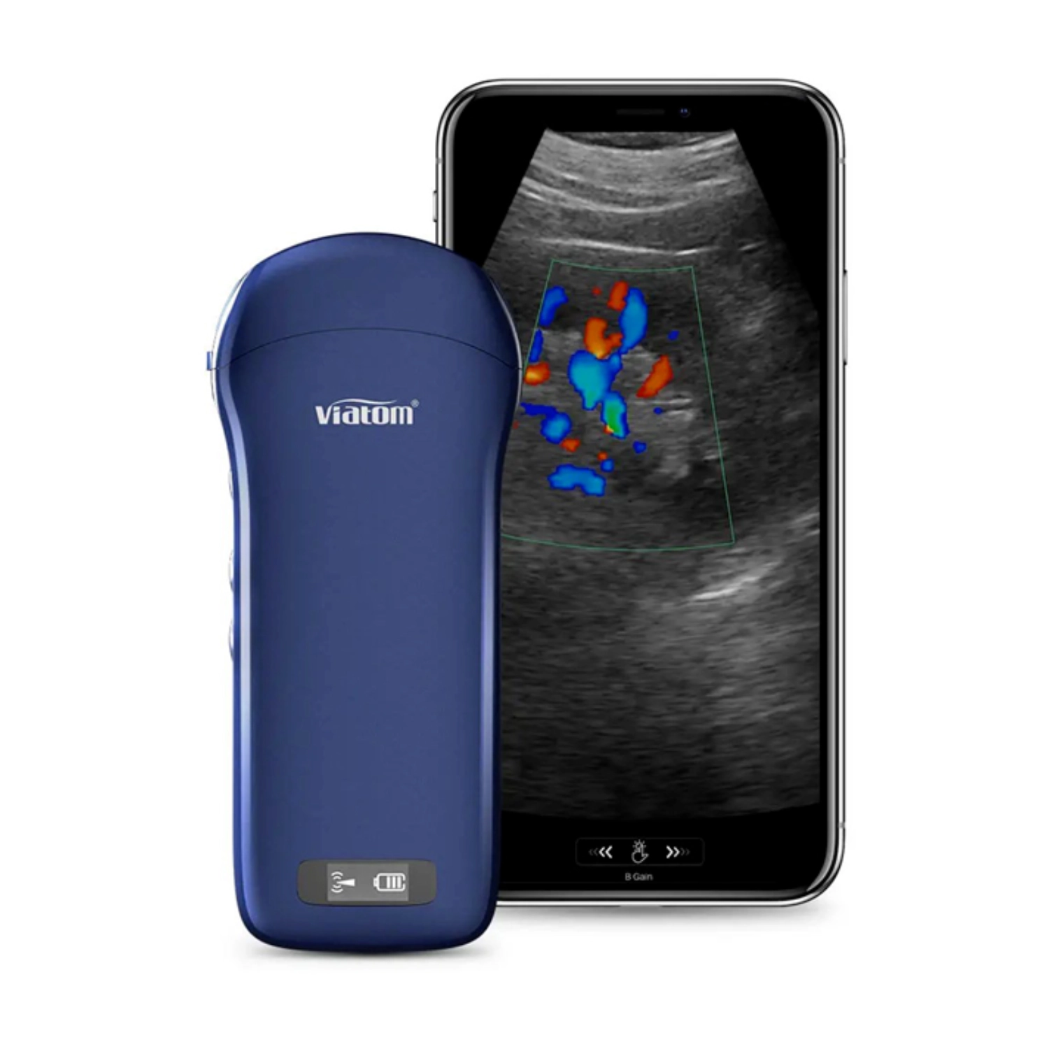 Ecografie - Sondă ecografie wireless  3 în 1 (linear + convex + cardiac)