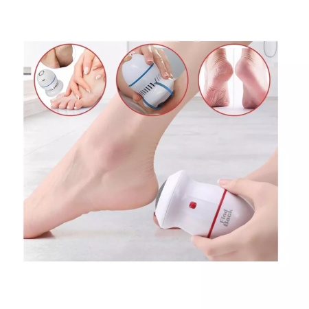 Dispozitiv Electric pentru Îndepărtarea Bătăturilor (Callus Remover) [1]