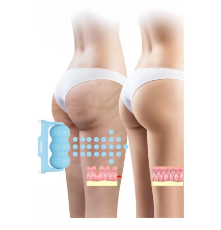Rolă de Masaj Facial și Corporal cu Efect de Gheață (Ice Roller / Skin Gym) [3]