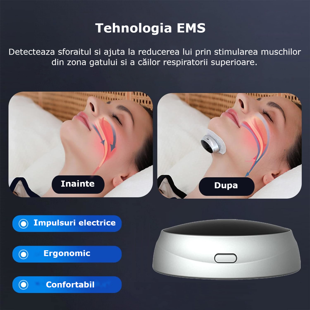Dispozitiv Inteligent Anti-Sforait Clavi, Portabil, Tehnologie EMS, Imbunatateste Calitatea Somnului, Detecteaza Sforaitul, Regleaza Ritmul Respiratiei, Amelioreaza Apneea, USB, Negru [5]