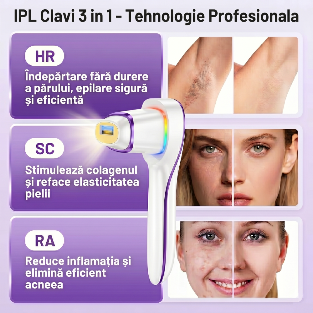 Epilator IPL 3 IN 1, Premium Clavi, Epilare Definitiva fara Durere, Inovatie Cap Rotativ 180°, 10 Nivele de Intensitate, Tehnologie Ice-Cooling, Senzor Piele cu Lumina LED, Alb/Mov [8]