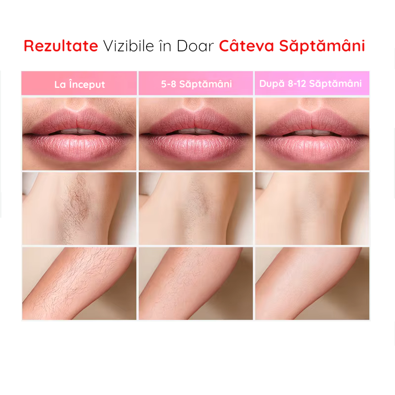 Epilator IPL Clavi, Premium, Functie ICE Cool cu Racire, Epilare Definitiva, Intinerire Piele, Reducere Acnee, 9 Trepte de Intensitate, 999 999 Pulsatii, 2 Capete de Schimb, Senzor Piele, Roz [8]