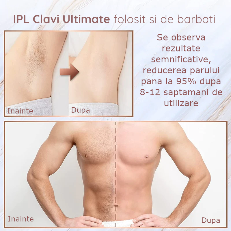 Epilator IPL Clavi, Ultimate, Functie ICE Cool cu Racire, Epilare Definitiva, Intinerire Piele, Reducere Acnee, 9 Trepte de Intensitate, 999 999 Pulsatii, Senzor Piele, Alb Nature [11]