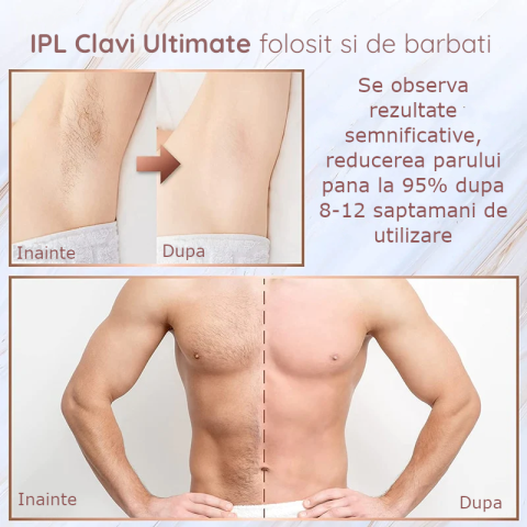 Epilator IPL Clavi, Ultimate, Functie ICE Cool cu Racire, Epilare Definitiva, Intinerire Piele, Reducere Acnee, 9 Trepte de Intensitate, 999 999 Pulsatii, Senzor Piele, Alb Nature [10]