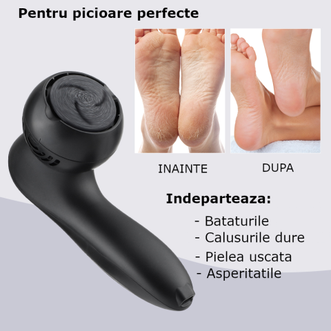 Pila Electrica pentru Talpi si Calcaie Clavi, cu 18 accesorii, Indepartare Piele Moarta si Bataturi, Afisaj Digital, Incarcare USB, Negru [2]