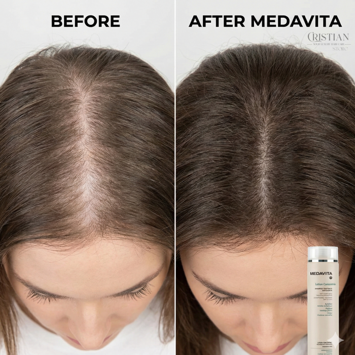 Sampon Anticadere Femei Medavita Lotion Concentree - Stimulare Circulatie [5]