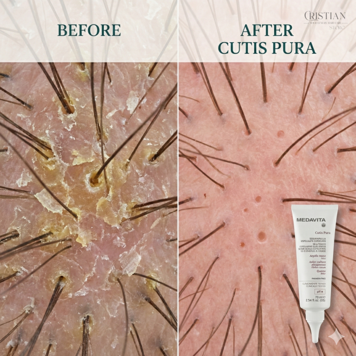 Scrub Detox Scalp si Fata Medavita Cutis Pura - Argila Rosie si Cuart [7]