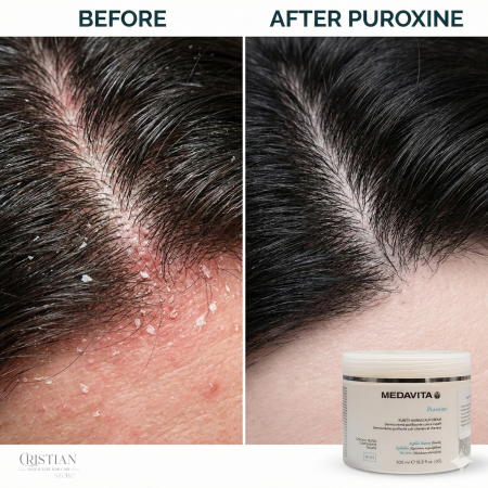 Dermo Crema Exfolianta Medavita Puroxine - Masca Antimatreata cu Argila [4]