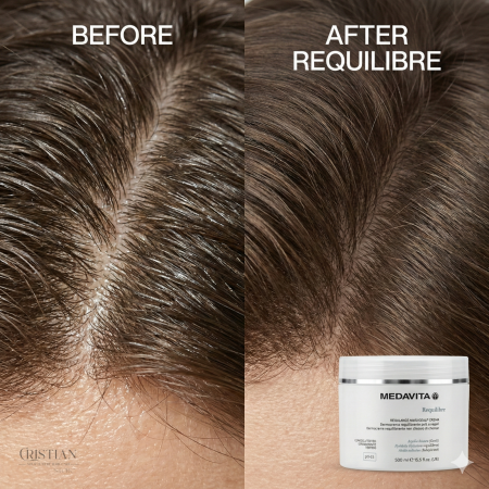 Dermo Crema Antisebum Medavita Requilibre - Masca Scalp Gras cu Argila [4]