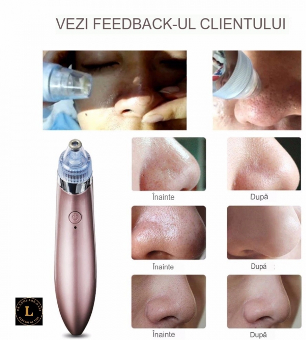 Aparat Electric pentru Indepartarea Punctelor Negre, Anti-Acnee, Curatator Reincarcabil pentru Ten, usor de utilizat [7]