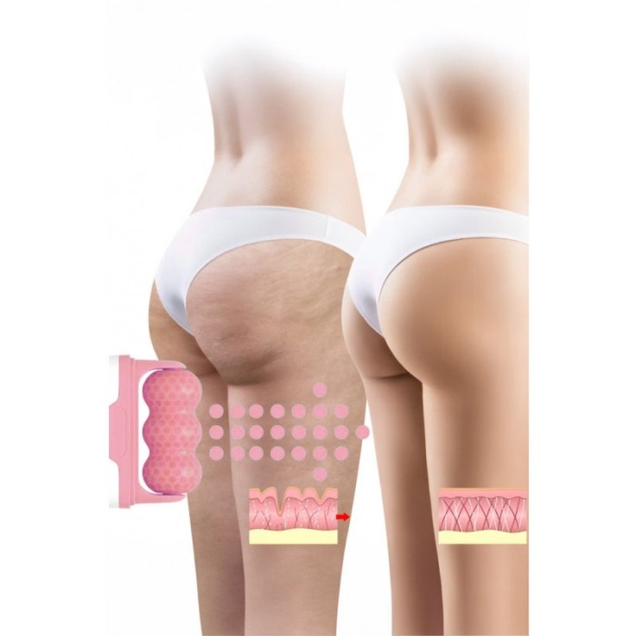 Aparat de masaj IceRejuven Doty®, facial si anticelulitic, cu 2 capete V si W, cu gheata, babypink [8]