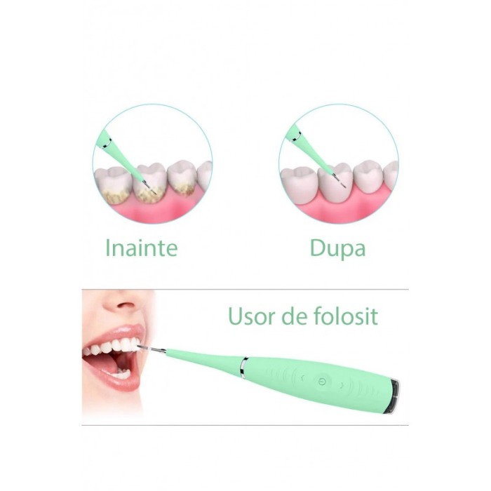 Dispozitiv sonic PerfectTeeth, elimina petele, placa bacteriana si tartrul, 31000 pulsatii/min, 20 cm, Doty® [8]