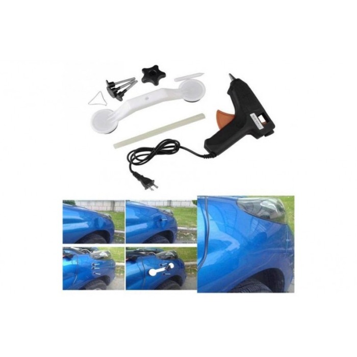 Kit pentru indreptarea coroseriei Fix it in 321 pistol cu adeziv, 2 ventuze, accesorii incluse, usor si practic,negru,doty [6]