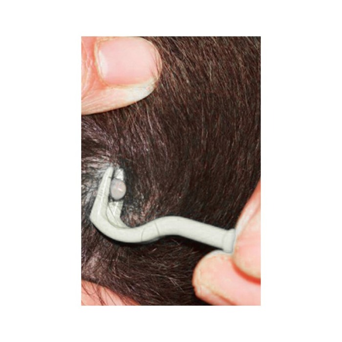 Set 2 Dispozitive pentru indepartarea capuselor NoTick Doty®, manual, 2 marimi, usor de utilizat, confort, gri [7]