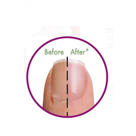 Masca reparatoare pentru unghii si cuticule TopMani, include 4 tratamente, cu ulei din seminte Japonica, Doty [5]