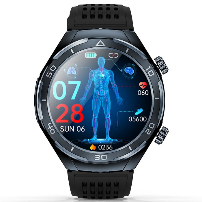 iSEN FD02 Szürke okosóra, 1.46 "HD, alvásjavítás, vércukorszint, PPG+ECG, HR, Bt hívás, SOS, hangalapú asszisztens, távoli ellátás [2]