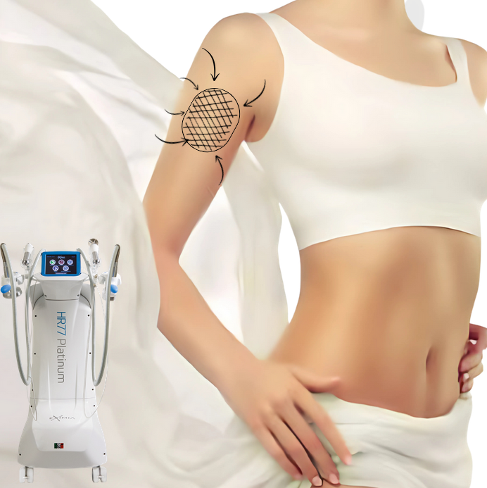 Abonament BRATE 6+1 Eximia HR77 – 6 Ședințe + 1 Împachetare Cadou – Slăbire Rapidă, Tonifiere și Lifting [2]