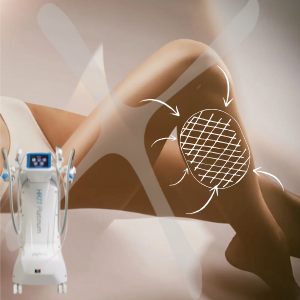 Abonament GAMBE 6+1 Eximia HR77 – 6 Ședințe + 1 Împachetare Cadou – Slăbire Rapidă, Tonifiere și Lifting [4]