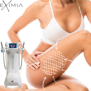 Abonament COAPSE 6+1 Eximia HR77 – 6 Ședințe + 1 Împachetare Cadou – Slăbire Rapidă, Tonifiere și Lifting [5]