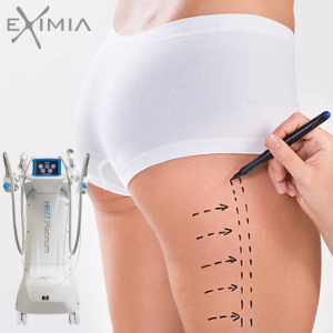 Abonament COAPSE 6+1 Eximia HR77 – 6 Ședințe + 1 Împachetare Cadou – Slăbire Rapidă, Tonifiere și Lifting [3]