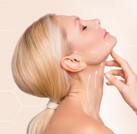 Tratament Zona Gâtului cu HIFU 3D sau Liposonix – Lifting, Fermitate și Întinerire [1]