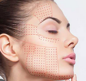 Tratament Facial Contur Mandibular cu HIFU 3D sau Liposonix – Redefinire, Lifting și Fermitate [1]