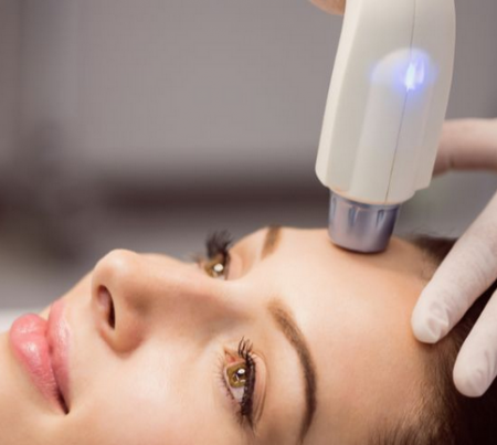 Tratament Facial Zona Frunții cu HIFU 3D sau Liposonix – Lifting, Fermitate și Reducerea Ridurilor [2]
