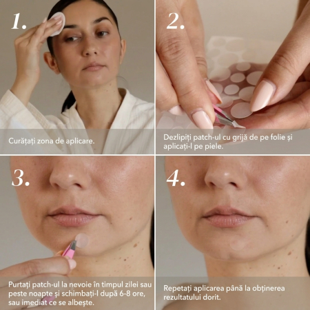 Plasturi pentru Coșuri APRICOT cu Hidrocoloid 72 buc [3]
