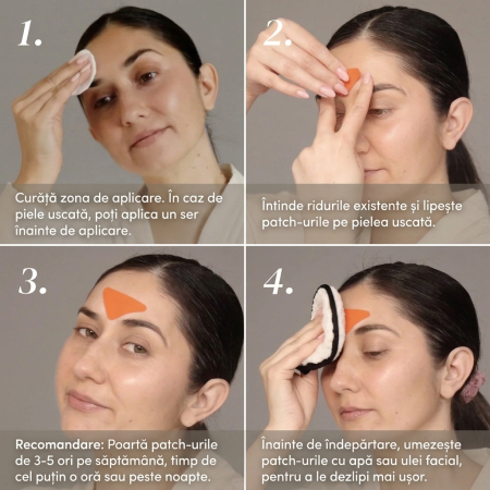 Plasturi APRICOT cu Niacinamidă pentru Ten Gras și Textură Neuniformă – 100 buc. [3]