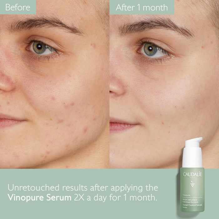Caudalie Vinopure Blemish Control Salicylic Serum 30ml [3]