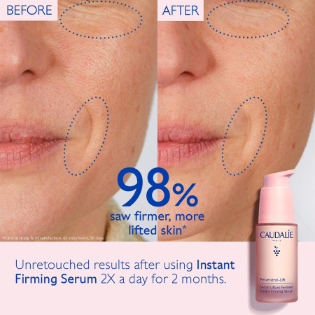 Caudalie Resveratrol-Lift Instant Firming Serum 30ml [3]