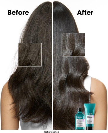 SE Scalp Advance Anti-Discomfort Shampoo 300ml [5]