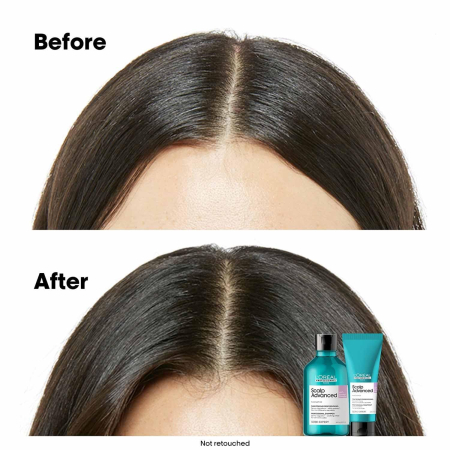SE Scalp Advance Anti-Discomfort Treatment 200ml [6]