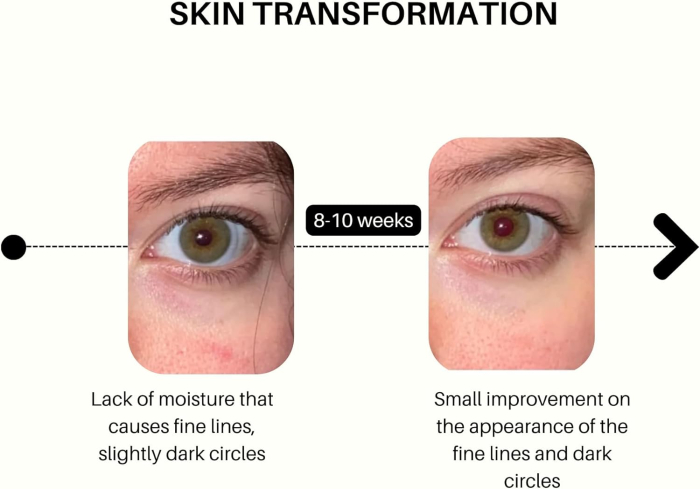 Siero Viso VOUS by Satin Naturel – Complex de Peptide Multimolecular & Acid Hialuronic – Efect de Ridicare (Lifting) și Fermitate – 50ml [6]