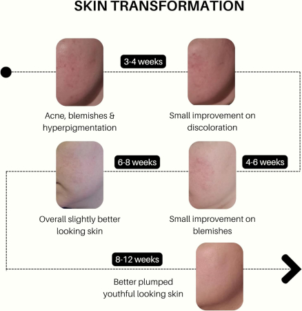 Siero Viso Nocturn VOUS by Satin Naturel – Retinaldehida (Retinal), Bakuchiol & Argireline – Efect Botox-Like și Regenerare Intensă – 50ml [3]