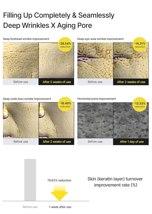 Retinal Shot Tightening Booster [4]